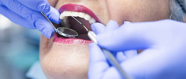 Best Dental Abscess Treatment in Combined Locks, WI